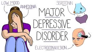 depressive disorder