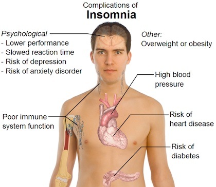 insomnia sleep disorder